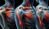 Acupuncture Techniques for Relieving Frozen Shoulder Effectively