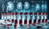 Kidney Blood Test in Blackburn: Your Essential Overview