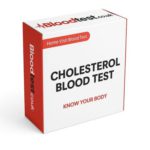 Cholesterol Blood Test Essentials in Yeovil